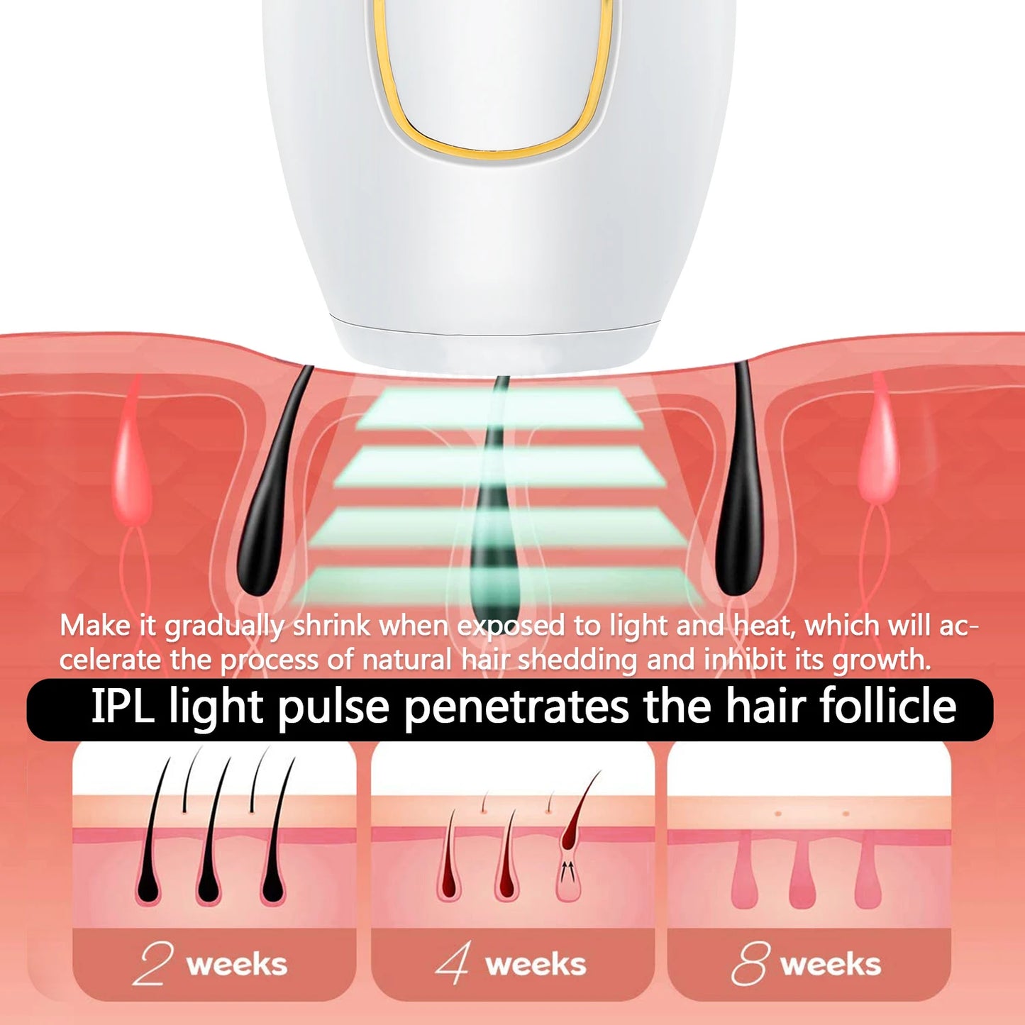 ÉPILATEUR IPL LUMIÈRE PULSÉE PROFESSIONNELLE - RÉSULTATS PERMANENTS GARANTIS DÈS 4 SEMAINES